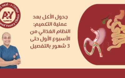 جدول الاكل بعد عملية التكميم: النظام الغذائي من الأسبوع الأول حتى 3 شهور بالتفصيل