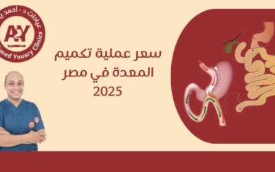سعر عملية تكميم المعدة في مصر 2025