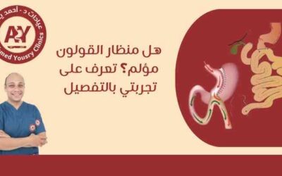 هل منظار القولون مؤلم؟ تعرف على تجربتي بالتفصيل