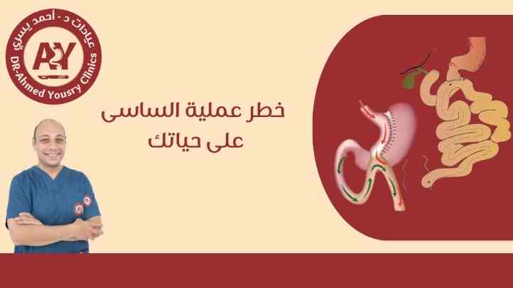 خطر عملية الساسي على حياتك 