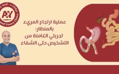 عملية ارتجاع المريء بالمنظار: تجربتي الكاملة من التشخيص حتى الشفاء