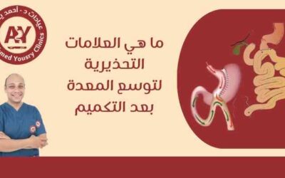 ما هي العلامات التحذيرية لتوسع المعدة بعد التكميم