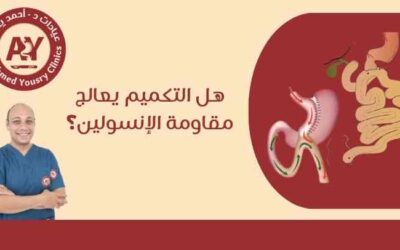 هل التكميم يعالج مقاومة الإنسولين؟