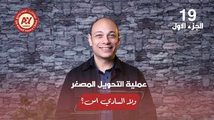 السادي إس vs التحويل المصغر: نفس نزول الوزن لكن أيهما أقل مشاكل؟