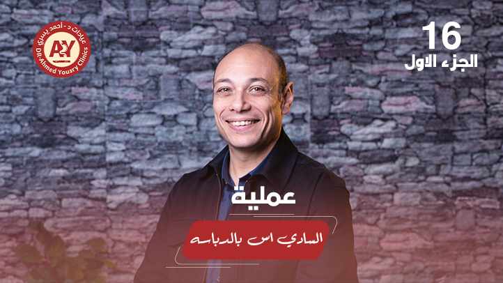 السادي إس بالدباسة: هل تمنح نتائج أفضل وتقلل المضاعفات؟